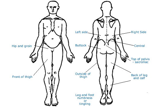 symptoms of back pain