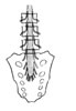 severe lower back pain
