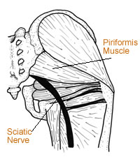piriformis muscle